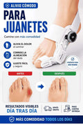 Corrector de Juanetes – Alinea Tu Pie Sin Cirugía