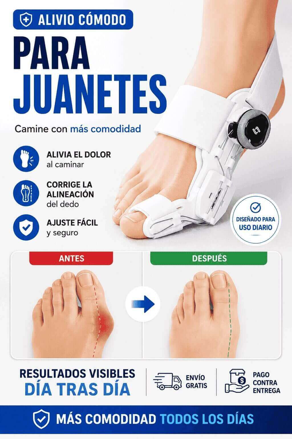 Corrector de Juanetes – Alinea Tu Pie Sin Cirugía